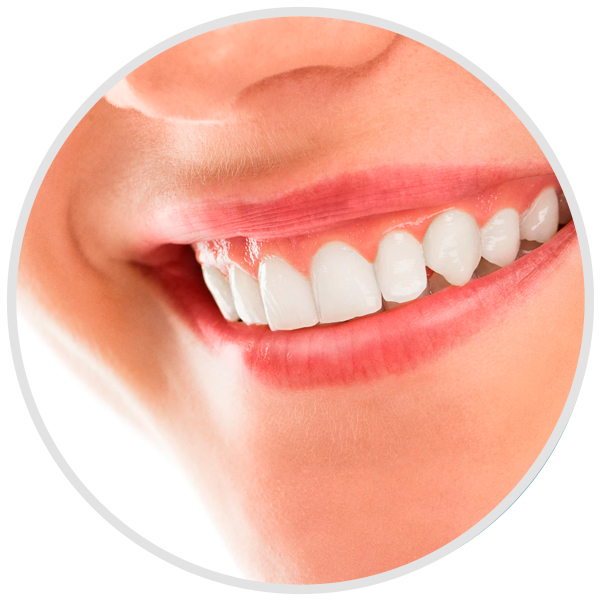 Avoid These Mistakes When Choosing “All On Four Dental Implants”